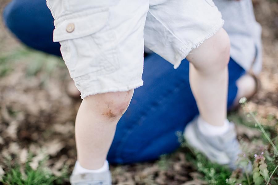 Skinned knees at this Mommy & Me Session by Knoxville Wedding Photographer, Amanda May Photos.